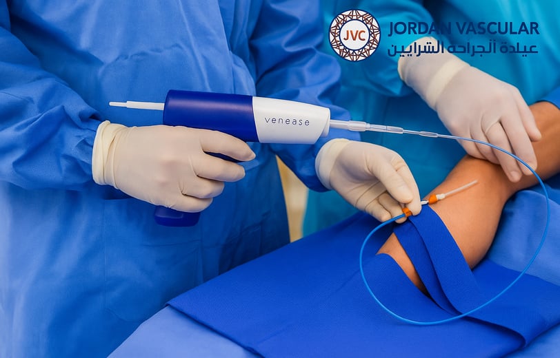 https://jordanvascular.com/path-to-your-venaseal-image.jpg