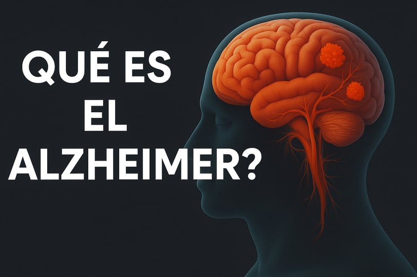 qué es el alceimer