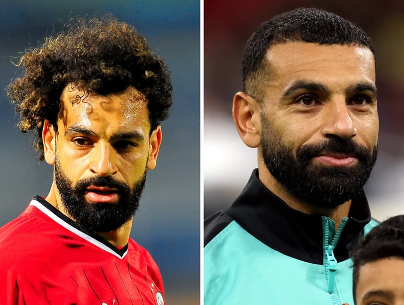 Mo salah before after hair transplant