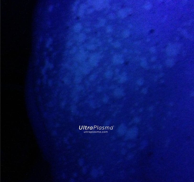 ultraplasma.com Tinea Versicolor woodlamp diagnosis