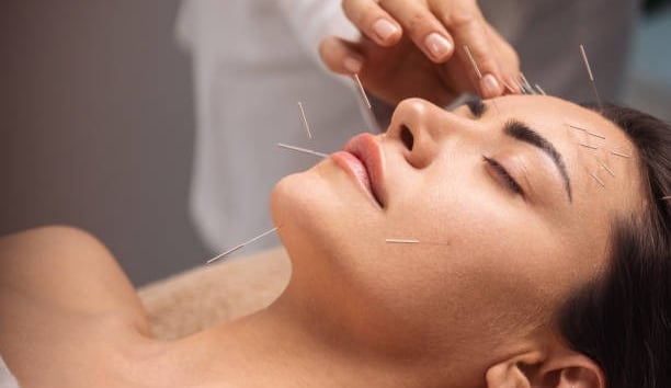Acupunture