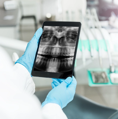 Implantologia dentale