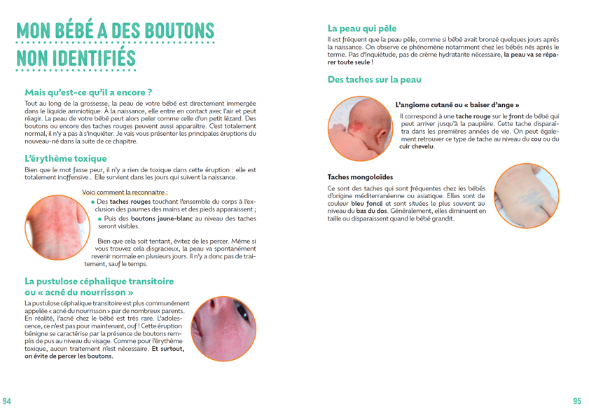 Exemple de chapitre du livre. Reconnaitre les boutons chez mon bébé