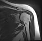 Shoulder MRI