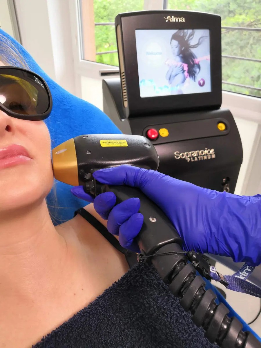 Women's laser hair removal facial treatment at SK Laser Aesthetics Broxbourne