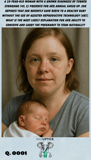 A woman with Turner Syndrome holding a baby in her arms