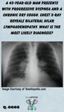 A chest x-ray demonstrating bilateral hilar adenoopathy