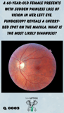 fundoscopy image of a cherry red spot