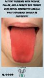 a person with an extended red tongue
