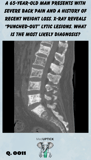 MRI imaging showing punch our lesions of the tailbone of the spine