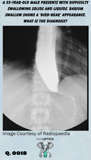 a gastrograffin image with a birds beak of an esophagus