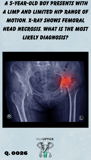a pelvic x-ray with a hip highlighted in red
