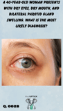 a close-up of a female's eye demonstrating redness and irritation of the sclera