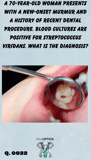 a close up of a cavity in a patient's mouth
