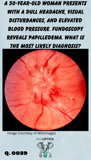 a close up fundoscopy image demonstrating papilledema