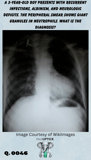 an x-ray of a child with a boot-shaped heart