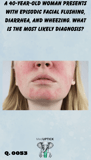 a close up image of a young caucasian woman with facial flushing