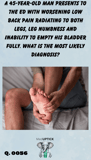 a man rubbing his foot due to pain in his soles