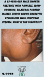 a close up image of the profile of a man with a parotid mass