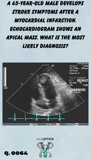 an echocardiogram image displaying an apical mass