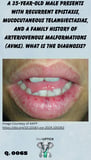 a close up image of a male's lips showing mucocutaneous telangiectasias