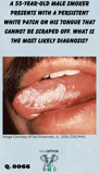 a male with a white lesion on the lateral side of his tongue