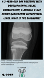an x-ray of the knee with radiodense metaphyseal lines of a toddler