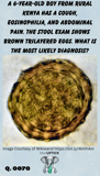 stool microscopy of a brown trilayered egg