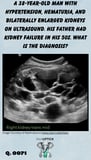 bilaterally enlarged kidneys on ultrasound