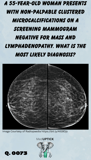 breast screening mammogram with microcalcifications