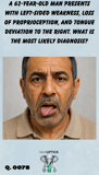 a middle-aged arabic male with unilateral facial weakness and right-sided tongue deviation