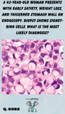 a histology slide showing signet ring cells