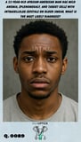 a young adult African American male with pale conjunctiva due to anemia has a concerned expression