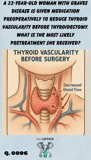 an illustration of a patient's neck showing the thyroid and major blood vessels