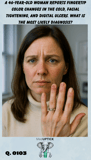 a Caucasian woman with ulcerations on the tips of her fingers