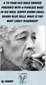 an elderly African American man smoking a cigarette