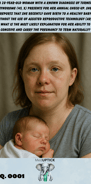 A woman with Turner Syndrome holding a baby in her arms