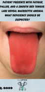 a person with an extended red tongue