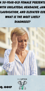 a middle-aged female with a very bad headache massaging her temple