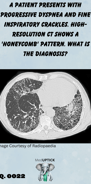 a CT scan demonstrating a 'honeycomb' lung pattern