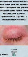 a closed eye of a woman where the skin is very red