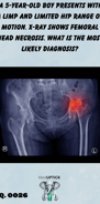 a pelvic x-ray with a hip highlighted in red