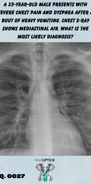 a chest x-ray with mediastinal air