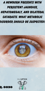 a close-up image of the eye of a child with a cataract
