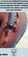 skin necrosis on a patient's leg