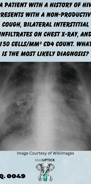 a chest x-ray with bilateral infiltrates