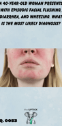 a close up image of a young caucasian woman with facial flushing
