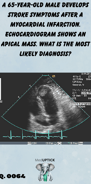 an echocardiogram image displaying an apical mass