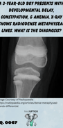an x-ray of the knee with radiodense metaphyseal lines of a toddler