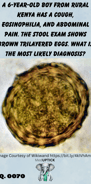 stool microscopy of a brown trilayered egg